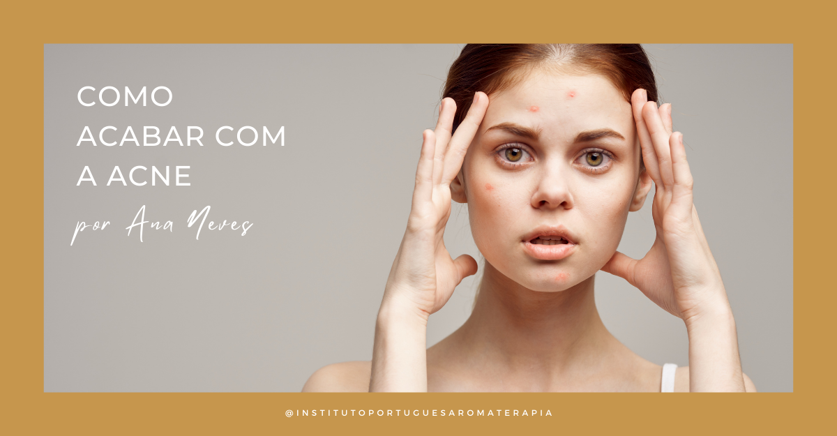 Acne Ana Neves